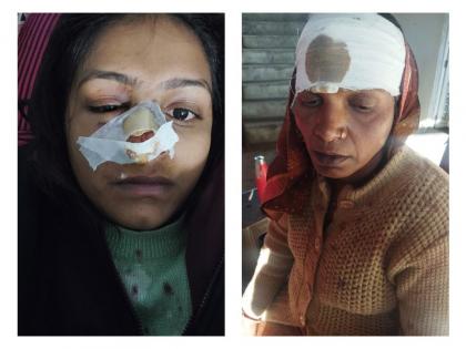 Ujjain: The goons tried to kidnap the girl by entering the house, beat up the parents and brother | उज्जैन: गुंडों ने लड़की को घर में घुसकर अगवा करने का किया प्रयास, मां-बाप और भाई को भी पीटा Ujjain: The goons tried to kidnap the girl by entering the house, beat up the parents and brother | उज्जैन: गुंडों ने लड़की को घर में घुसकर अगवा करने का किया प्रयास, मां-बाप और भाई को भी पीटा