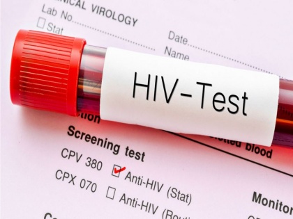NHRC notice to Maharashtra over 4 children testing HIV+ following blood transfusion | बिना जांच के खून चढ़ाने पर 4 बच्चों के एचआईवी संक्रमित पाए जाने पर महाराष्ट्र सरकार को नोटिस जारी