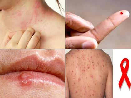 early sign and symptoms of HIV/Aids in women and kids, risk factors, prevention in Hindi | सावधान! महिलाओं और बच्चों में HIV होने से पहले शरीर देता है 22 चेतावनी, ऐसे बचें