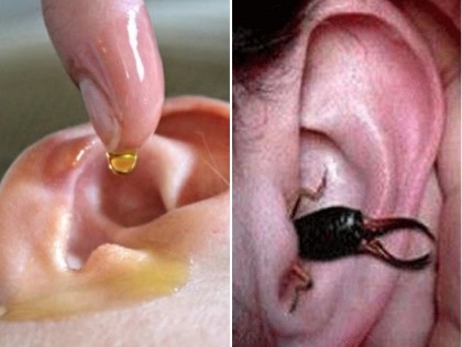 home remedies for ear pain, wax, itching, remove any kind of insects inside the ear in a minute | कान में घुसे किसी भी तरह के कीड़े को एक मिनट में ऐसे निकालें बाहर