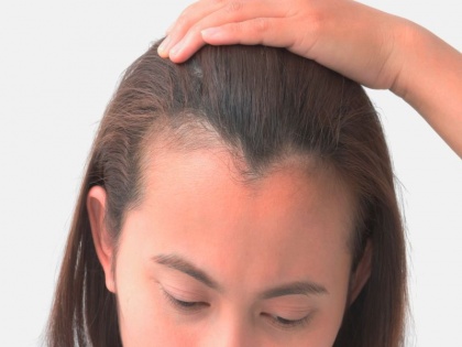 Hair care tips in Hindi: Home remedies for hair fall and baldness, hair loss and baldness treatment for men and women in Hindi | नारियल तेल में इस चीज को मिलाकर लगा लें, कुछ दिनों में बालों का झड़ना, गंजापन हो जाएगा दूर