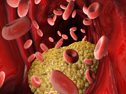 how to get rid Cholesterol: 5 best and effective home remedies to reduce high Cholesterol level without medicine | कोलेस्ट्रॉल कैसे कम करें : कोलेस्ट्रॉल कितना होना चाहिए? जानिये कोलेस्ट्रॉल कम करने के 5 असरदार घरेलू उपाय