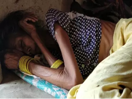 Scary figures of starvation | भुखमरी के डराते आंकड़े