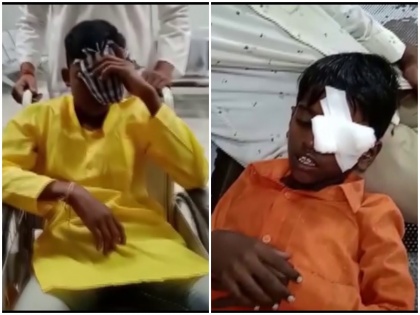 Diwali in Hyderabad10 people injured hospitalized while bursting crackers fire in noida | हैदराबाद में दिवाली पर पटाखे फोड़ने के दौरान 10 लोग घायल, अस्पताल में भर्ती, ग्रेटर नोएडा की वेदांतम सोसाइटी के 17वीं मंजिल पर लगी आग