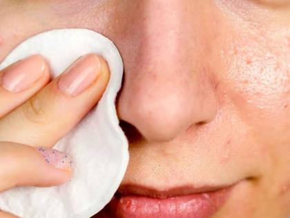 Beauty Tips: how to get rid of blackheads, how to get rid of blackheads overnight | Beauty Tips: अंडे में मिलाकर चेहरे पर लगाएं ये एक चीज, गायब हो जाएंगे सारे ब्लैक हेड्स-बच जाएंगे पार्लर के हजारों रुपए