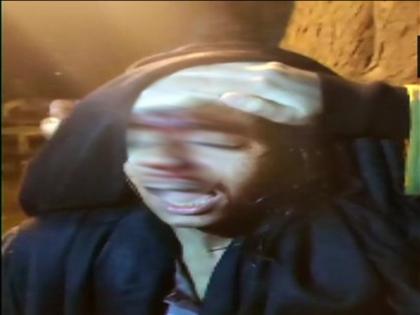 I have been brutally attacked by goons wearing masks says JNUSU President Aishe Ghosh | JNU: फीस बढ़ाने के खिलाफ प्रदर्शन कर रहे छात्रों पर नकाबपोश गुंडों का हमला, छात्र संघ अध्यक्ष आयशी घोष ने कहा- बुरी तरह पीटा