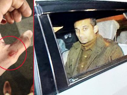 JNU Protest: protester at Vijay Chowk bit an IPS Officer when the police officer was trying to stop | JNU Protest में दोस्त को बचाने के लिए युवती ने चबा लिया IPS अधिकारी का अंगूठा
