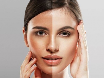 How to get fair skin naturally: 5 Home remedies tips in Hindi to get fair skin, Skin Care tips in Hindi, Beauty Hacks | निखरी त्वचा के साथ कुछ ही दिनों में मिलेगा गोरा रंग, अगर अपना लिए ये 5 घरेलू टिप्स