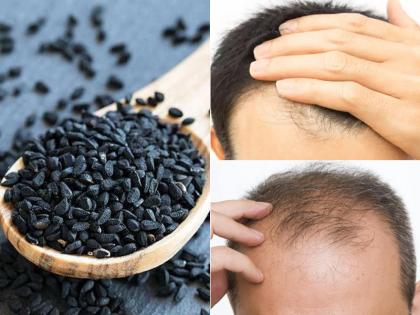 झड़ते बालों से परेशान हैं, ऐसे लगाएं बालों में कलौंजी, 5 हेयर प्रॉब्लम्स होंगी दूर