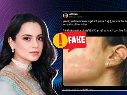 Fact Check slap mark on Kangana Ranaut know the truth of the viral photo | Fact Check: क्या कंगना रनौत के गाल पर पड़े थप्पड़ के निशान, जानिए वायरल फोटो का सच Fact Check slap mark on Kangana Ranaut know the truth of the viral photo | Fact Check: क्या कंगना रनौत के गाल पर पड़े थप्पड़ के निशान, जानिए वायरल फोटो का सच