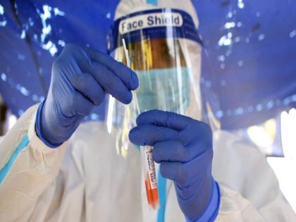 Covid new strain Omicron update: Doctor with no foreign travel history infected with Omicron in Karnataka in India | Covid strain Omicron: न कहीं गया, न आया फिर भी 'ओमीक्रोन' की चपेट में आ गया डॉक्टर, जानिए मरीज में क्या लक्षण दिखे Covid new strain Omicron update: Doctor with no foreign travel history infected with Omicron in Karnataka in India | Covid strain Omicron: न कहीं गया, न आया फिर भी 'ओमीक्रोन' की चपेट में आ गया डॉक्टर, जानिए मरीज में क्या लक्षण दिखे