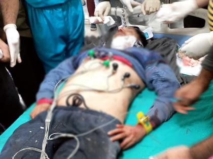 Jammu Kashmiri Pandit Krishna Puran Bhat killed in Shopian terrorists shot while walking in house | जम्मू-कश्मीरः शोपियां में कश्मीरी पंडित की हत्या, घर में टहलते वक्त आतंकियों ने मारी गोली, अस्पताल में तोड़ा दम