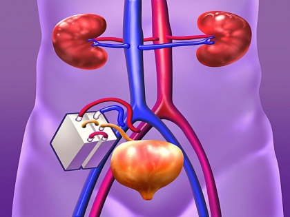 Scientists Have Developed a Bionic Kidney for kidney transplantation and dialysis | वैज्ञानिकों ने बना ली आर्टिफिशियल किडनी, डायलिसिस के लिए अब हर दूसरे दिन नहीं भागना पड़ेगा अस्पताल