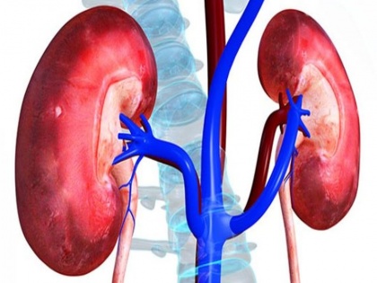 Doctors remove world's largest kidney in Delhi, know signs and symptoms of ADPKD | दिल्ली में डॉक्टरों ने निकाली 7.4 किलो की दुनिया की सबसे भारी किडनी, इस रोग से था पीड़ित