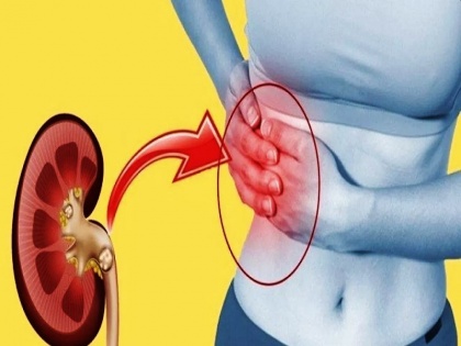 kidney stone kidney ki pathri: causes, symptoms, risk factors, treatment, home remedies, foods, kidney ilaj, pathri ka dawa, ayurvedic ilaj, kidney dard ka ilaj in Hindi | किडनी और पेशाब की नली में अटकी हुई पथरी को जल्दी बाहर निकाल सकती हैं ये 2 चीजें