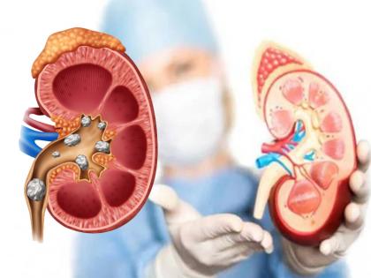 us-surgeons-successfully-test-pig-kidney-transplant-human-patient | डॉक्टरों को मिली बड़ी सफलता, मानव शरीर में सुअर की किडनी का सफल ट्रांसप्लांट किया us-surgeons-successfully-test-pig-kidney-transplant-human-patient | डॉक्टरों को मिली बड़ी सफलता, मानव शरीर में सुअर की किडनी का सफल ट्रांसप्लांट किया