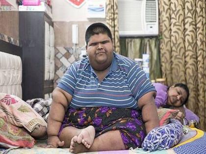 World's Heaviest Mihir Jain Weighing 237 Kg went through surgery , now walk easily | 237 किलो के दुनिया के सबसे वजनी बच्चे मीहिर का ऑपरेशन, अब चल सकेगा अपने सहारे