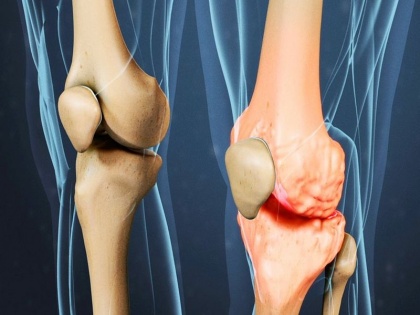 Knee pain exercise in Hindi: Do 5 easy exercise to make your knee strong and get rid pain | Knee pain exercise: घुटनों को मजबूत बनाने और दर्द से राहत पाने के लिए करें ये 5 व्यायाम