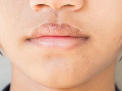 useful homemade remedies to lighten dark lips | काले होंठों से घरेलू नुस्खे की मदद से पाएं छुटकारा, जल्द मिलेंगे मनचाहे परिणाम