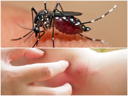Monsoon Health Tips: plants, home remedies help repel mosquitoes and other insects around your yard | Monsoon Health Tips: डेंगू मच्छरों का नामोनिशान मिटा देंगे ये 4 पौधे