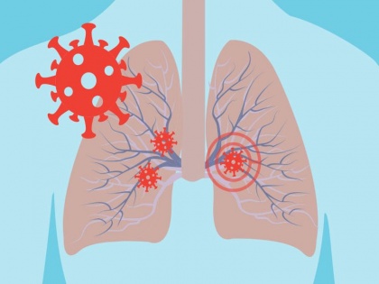Coronavirus effects on lungs: 8 tips to boost lung capacity and make them strong to fight covid-19 virus | फेफड़े खराब करके मरीज की जान ले लेता है कोरोना, फेफड़ों को मजबूत बनाने के लिए करें ये 8 आसान काम