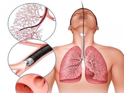How to detox lungs naturally: 10 easy tips and home remedies to clean lungs, natural ways to detoxify lungs at home, tips to clearing the lungs in Hindi | फेफड़े साफ करने के उपाय : फेफड़ों में जमा गंदगी को बाहर निकालने और मजबूत बनाने के 10 आसान घरेलू उपाय