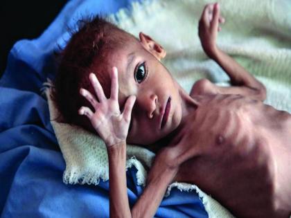 Dr Aastha Kant blog: Pay attention to the worrying situation of child malnutrition in Maharashtra | डॉ. आस्था कांत का ब्लॉग: महाराष्ट्र में बाल कुपोषण की चिंताजनक स्थिति पर दें ध्यान Dr Aastha Kant blog: Pay attention to the worrying situation of child malnutrition in Maharashtra | डॉ. आस्था कांत का ब्लॉग: महाराष्ट्र में बाल कुपोषण की चिंताजनक स्थिति पर दें ध्यान
