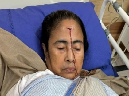 Mamata Banerjee suffers major injury in accident, taken to hospital, says TMC | West Bengal: दुर्घटना में ममता बनर्जी को सिर पर लगी गंभीर चोट, पार्टी ने दी जानकारी