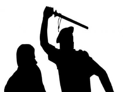 Man dies in police custody, family members allege torture, know the whole matter | पुलिस हिरासत में बंद शख्स की अस्पताल में हुई मौत, परिजनों ने लगाया प्रताड़ना का आरोप, जानिए पूरा मामला Man dies in police custody, family members allege torture, know the whole matter | पुलिस हिरासत में बंद शख्स की अस्पताल में हुई मौत, परिजनों ने लगाया प्रताड़ना का आरोप, जानिए पूरा मामला