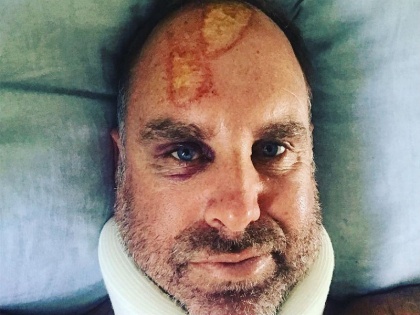 Matthew Hayden hospitalised after Spine Fracture in surfing accident | पूर्व ऑस्ट्रेलियाई ओपनर मैथ्यू हेडेन को लगी गंभीर चोट, रीढ़ की हड्डी में फ्रैक्चर के बाद अस्पताल में भर्ती