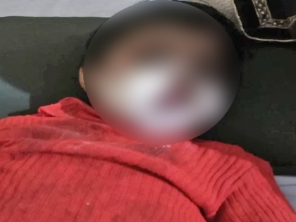 Uttar Pradesh: Three-year-old girl burnt in the mouth, the condition of the innocent is serious | उत्तर प्रदेश: तीन साल की बच्ची के मुंह में फोड़ा बम, मासूम की हालत गंभीर
