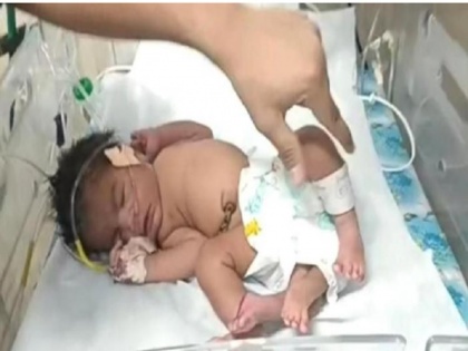 Viral: A woman has given birth to a baby girl with 4 legs in Gwalior, Madhya Pradesh | Viral: महिला ने 4 पैरों वाली बच्ची को दिया जन्म, देखने के लिए उमड़ी लोगों की भीड़, जानिए पूरा किस्सा