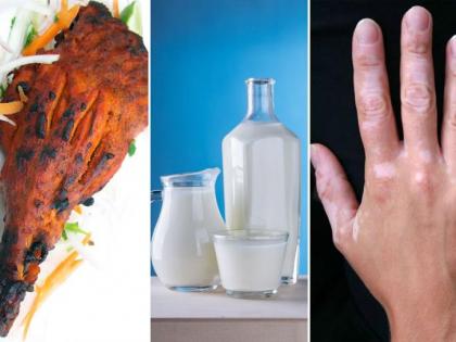 bad food combinations: do not eat these foods with milk in Hindi | World Milk Day: मछली, चिकन जैसी ये 10 चीजें खाने के बाद न पियें दूध, हो सकती है ऐसी हालत