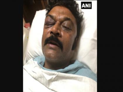 Karnataka: FIR filed against Congress MLA JN Ganesh by MLA Anand Singh on charges of assault | कर्नाटक: कांग्रेस विधायक ने पार्टी के ही MLA के खिलाफ दर्ज कराई FIR, रिजॉर्ट में दोनों नेताओं के बीच हुई हाथापाई Karnataka: FIR filed against Congress MLA JN Ganesh by MLA Anand Singh on charges of assault | कर्नाटक: कांग्रेस विधायक ने पार्टी के ही MLA के खिलाफ दर्ज कराई FIR, रिजॉर्ट में दोनों नेताओं के बीच हुई हाथापाई