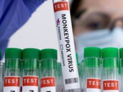 Monkeypox in Delhi 31-year old woman tests positive takes India's tally to 9 lnjp | Monkeypox in Delhi: दिल्ली में चौथा मामला, नाइजीरिया की 31 वर्षीय महिला पॉजिटिव