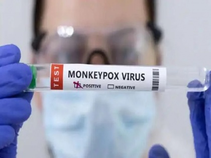 India's First Monkeypox Patient Completely Cured | भारत का पहला मंकीपॉक्स रोगी पूरी तरह से हुआ ठीक, केरल की स्वास्थ्य मंत्री ने दी जानकारी