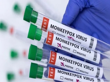 Kerala reports India's third monkeypox case in man who returned from UAE | Monkeypox in India: केरल में दर्ज हुआ एक और मंकीपॉक्स का मामला, कुल संख्या हुई 3, UAE से लौटा था संक्रमित व्यक्ति