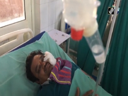 Moradabad stone-pelting: Injured doctor narrates horrific incident watch video | Video: 'मारो-मारो, भूखा रखते हो, गलत इंजेक्शन लगाते हो', मुरादाबाद में घायल डॉक्टर ने सुनाई आपबीती, बताया कितना खौफनाक था मंजर