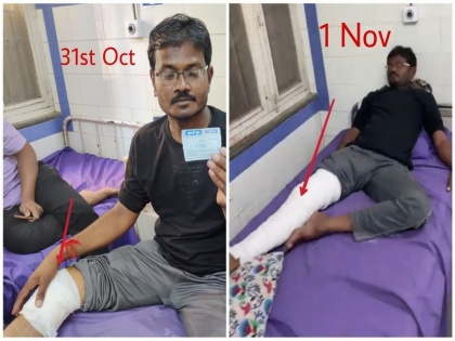 Morbi Incident bandage injured person tied plastered same during PM Modi's visit Shocking claims social media | मोरबी हादसा: जिस घायल शख्स को बांधी गई थी पट्टी उसी पर पीएम मोदी के दौरे के समय चढ़ा दिया पलास्टर! सोशल मीडिया पर हैरान करने वाले दावे