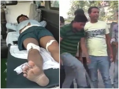 Motihari Professor attacked by people allegedly commenting on Vajpayee, News Updates | मोतिहारीः जानलेवा हमले पर पीड़ित प्रोफेसर ने कहा- 'वाजपेयी बहाना थे, वीसी के खिलाफ बोलने पर निशाना बनाया गया'