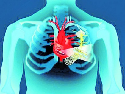 New imaging tool for diagnosing heart disease | दिल की बीमारी का पता लगाने में हो सकेगा एमआरआई का इस्तेमाल