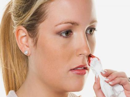 Health and Diet tips in Hindi: vitamin k deficiency causes, symptoms, foods list, treatment, natural and home remedies in Hindi | पेशाब में खून, नाक से खून, पीरियड्स में हैवी ब्लीडिंग की वजह है इस पोषक तत्व की कमी, खायें ये चीजें Health and Diet tips in Hindi: vitamin k deficiency causes, symptoms, foods list, treatment, natural and home remedies in Hindi | पेशाब में खून, नाक से खून, पीरियड्स में हैवी ब्लीडिंग की वजह है इस पोषक तत्व की कमी, खायें ये चीजें