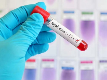 Nipah in Kerala containment zones created ICMR delivers antibody | Nipah Virus: कन्टेनमेंट जोन बनाए गए, आईसीएमआर ने पहुंचाई एंटीबॉडी