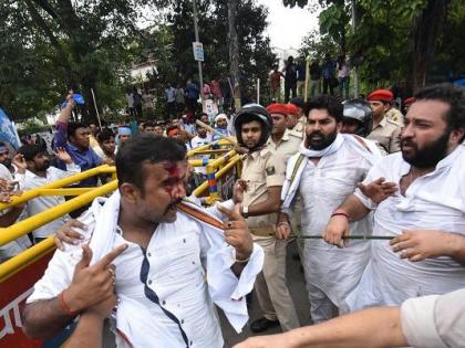Youth Congress Protest in Patna on Muzaffarpur Shelter Home sex abuse case | मुजफ्फपुर कांड को लेकर पटना में NSUI का प्रदर्शन, लाठीचार्ज में फट गया कांग्रेस विधायक का सिर