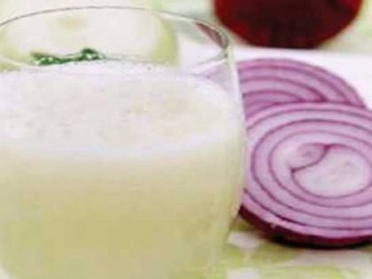 Onion benefit hairfall problem, diabetes, skin problem period problem Onion work on it | Onion benefit: गुणों का भंडार है प्याज, टूटते बाल, डायबिटीज, स्किन से लेकर पीर‍िड्स में असरदार