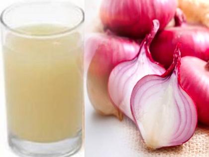 Onion oil for hair growth know benefits, how to use | Onion oil for hair growth: झड़ते बालों और डैंड्रफ से हैं परेशान? इस तरह करें प्याज के तेल का इस्तेमाल