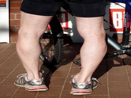 only night leg pain is dangerous for fitness health tips in hindi | क्या आपके पैरों में भी केवल रात में ही होता है दर्द तो यहां जाने इसके पीछे का कारण, पढ़ें एक्सपर्ट्स की राय only night leg pain is dangerous for fitness health tips in hindi | क्या आपके पैरों में भी केवल रात में ही होता है दर्द तो यहां जाने इसके पीछे का कारण, पढ़ें एक्सपर्ट्स की राय