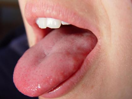 World Oral Health Day History:Know about the Oral cancer symptoms, reasons, cure and precautions on this World Oral Health Day 2018 | World Oral Health Day: ओरल कैंसर के कारण, लक्षण, बचाव और इलाज