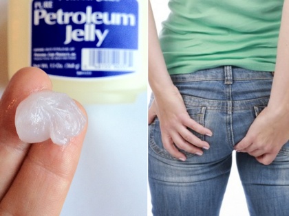 health way to use petroleum jelly to get relief from piles | बवासीर का रामबाण इलाज है पेट्रोलियम जेली, ऐसे करें इस्तेमाल