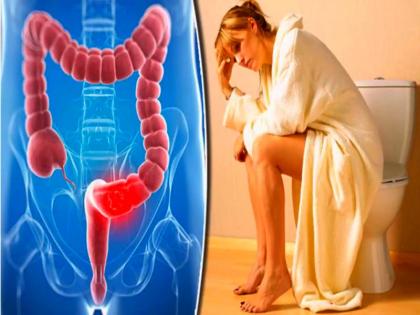 How to get rid of old piles hemorrhoids: Ayurvedic treatment for Piles, natural ways to treated piles without medicine and surgery in Hindi | how to get rid piles: पुरानी बवासीर का इलाज करने के लिए आजामायें ये 8 घरेलू उपाय
